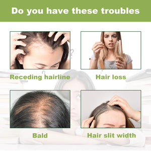 EELHOE Rosemary Dense Hair Spray Hydrates Roots For Increased Elasticity Restoring Shine Anti-Set Hair Spray