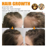 EELHOE Biotin Premium Haarwuchsseife, starke und feuchtigkeitsspendende Haarwurzel zur Reduzierung von Trockenheit, glatte, schöne, saubere Haarseife