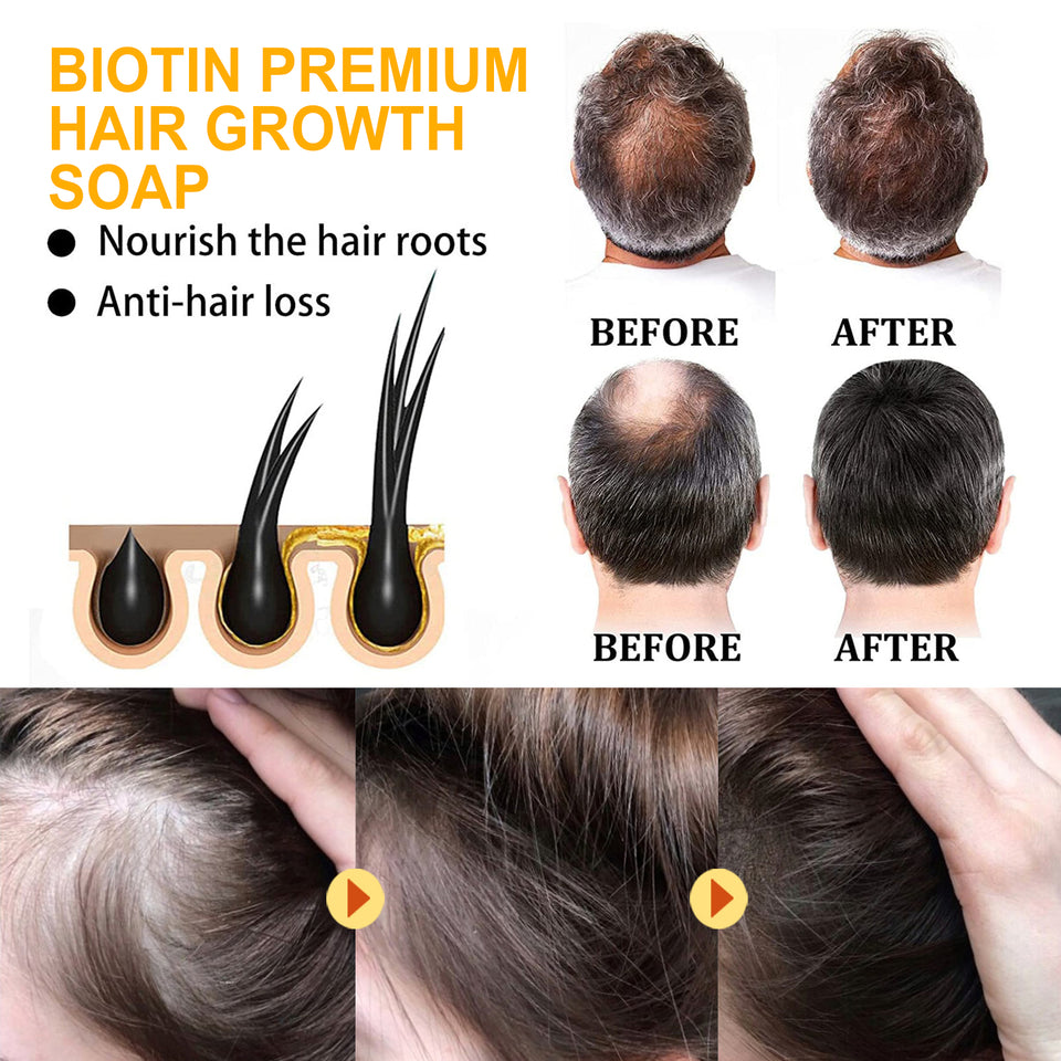 EELHOE Biotin Premium Haarwuchsseife, starke und feuchtigkeitsspendende Haarwurzel zur Reduzierung von Trockenheit, glatte, schöne, saubere Haarseife